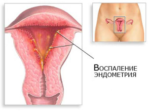 симптомы, диагностика и лечение