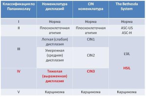 Различная классификация дисплазий