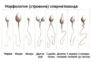Важный показатель морфологие или строение