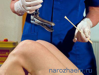 Техника забора мазка на цитологию